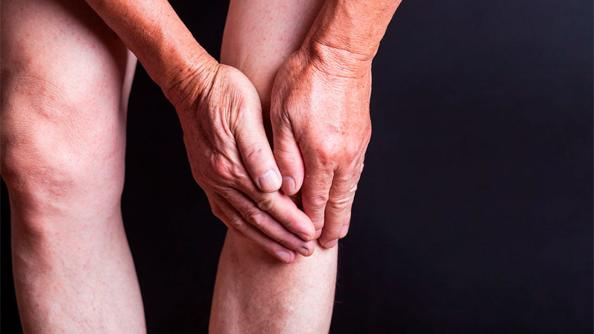 Alternativa no quirúrgica para el tratamiento de la artrosis de rodilla